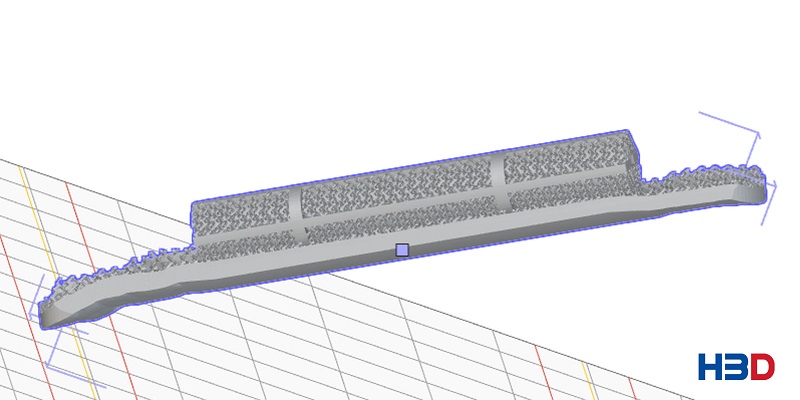 Модель эндопротеза 